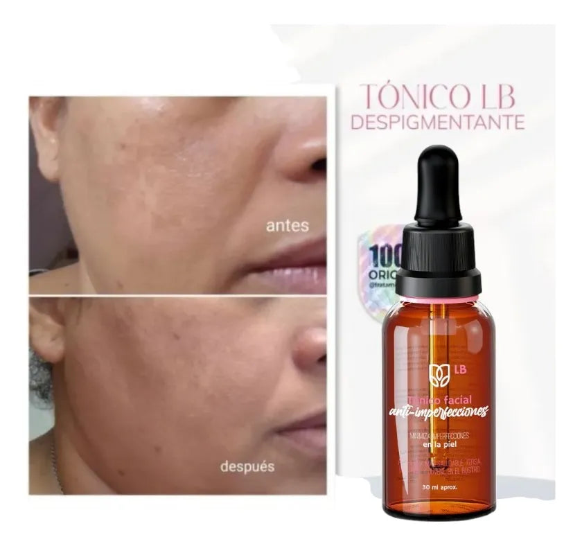 Tónico facialnAnti-Imperfeciones  LB SAS